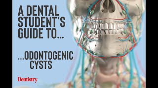 ODONTOGENIC CYST ODONT ACADEMY OF LEARNING 8497888181 [upl. by Orest]