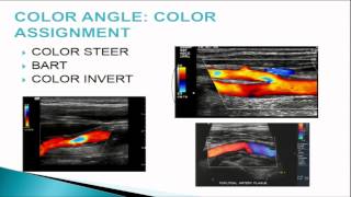 Doppler and Color Flow Imaging Fundamentals for PointofCare Applications [upl. by Kirkpatrick]