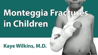 Monteggia Fractures In Children [upl. by Nitsirt994]