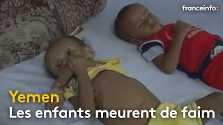 Yémen  les enfants meurent de faim  franceinfo [upl. by Tallie]