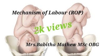 Mechanism of labourright occipito posterior by babitha mathew [upl. by Enilehcim]