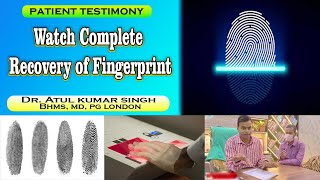 How to recover fingerprints  Fingerprint problem  Fingerprint problem solution  Fingerprints [upl. by Klepac]