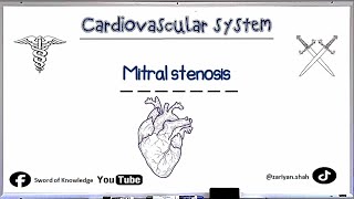 Mitral Stenosis  Murmurs  Cardiovascular system  Urdu Hindi [upl. by Cerellia]