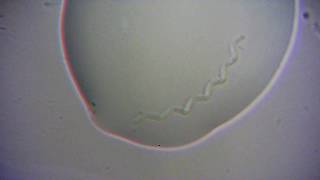 Incredible Footage Of Spirochete Bacteria 2500X [upl. by Elpmet]