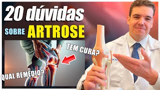 20 PRINCIPAIS DÚVIDAS SOBRE ARTROSE [upl. by Hara]