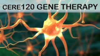 Gene Therapy Medical Animation CERE120 [upl. by Cannell]