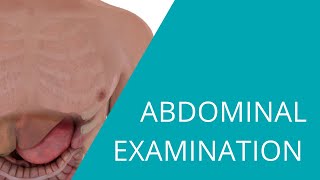 Abdominal Examination  Examination of the abdomen and gastrointestinal system [upl. by Eiznekcam]