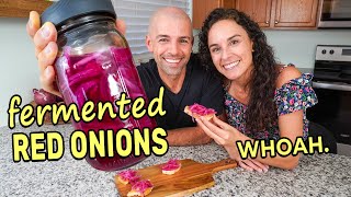 VIRAL RECIPE TEST Quick Pickled vs Fermented Red Onions 3 Recipes [upl. by Layney]