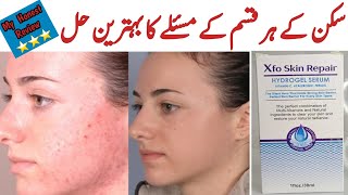 خراب سے خراب سکن کو دنوں میں ٹھیک کرو Xfo Skin Repair Serum [upl. by Ym]