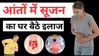 आंतो में सूजन Crohns disease  Causes Symptoms Diagnosis and Treatment crohnsdisease [upl. by Akkahs580]