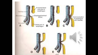 Embryology GIT Part 2 [upl. by Susanne]