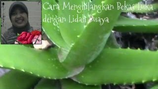 Cara Menghilangkan Bekas Luka Lama dengan Lidah Buaya Manfaat Lidah Buaya [upl. by Enilec]