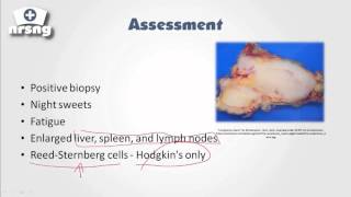 Lymphoma NCLEX® Review  NRSNGacademycom [upl. by Schober729]