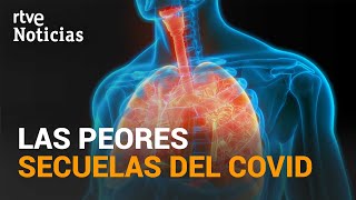 Primer DOBLE TRASPLANTE PULMONAR en España para un paciente COVID19  RTVE Noticias [upl. by Lenna434]