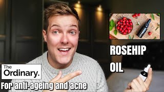 ROSEHIP OIL  30 day test on oily skin  The Ordinary rosehip oil  rosehip oil before and after [upl. by Vento354]