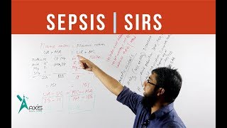 Sepsis  SIRS Multi organ failure  বাংলা [upl. by Aisauqal]