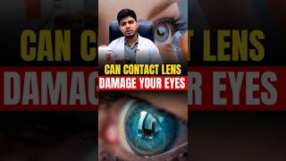 Can Contact Lenses Cause Blindness [upl. by Neukam]