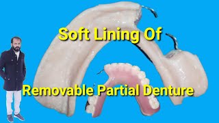 How to make soft liner Removable partial dentur  Soft Liner RPD by Haider [upl. by Brena]