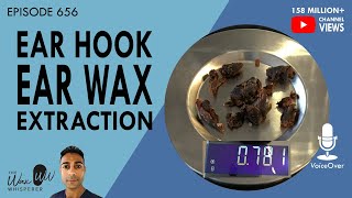 656  Ear Hook Ear Wax Extraction [upl. by Elleval35]