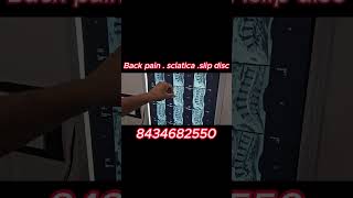 backpaintreatment chiropractic doctor sciatica backpain back backpainrelief frozenshoulder [upl. by Elleahcim]