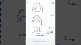 Épanchement pleural et ponction pleurale [upl. by Doomham]