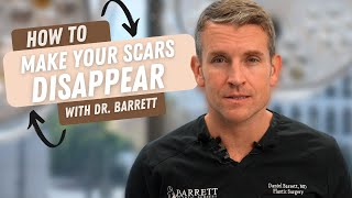 How To Make Your Scars Disappear  Barrett Plastic Surgery [upl. by Sherlocke590]