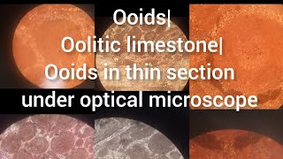 Ooids ooids in thin section under optical microscope Oolitic limestone [upl. by Marlie]