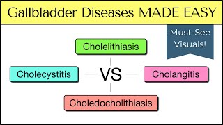 Cholecystitis vs Cholelithiasis vs Cholangitis vs Choledocholithiasis Nursing USMLE [upl. by Theodor945]