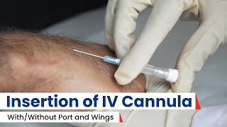 IV Cannulation Insert IV Cannula Tips amp Techniques  Best Procedure 2024 [upl. by Enidanreb]