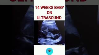 14 weeks baby on ultrasound pregnancy pregnancyjourney babyonusg [upl. by Winson]