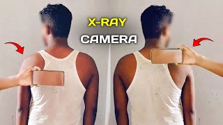 xray camera body scanner app  body scanner [upl. by Schafer]