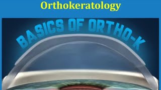 Orthokeratologyaka  Ortho K lenses Optometry Lecture by Seema Kumari CL Gupta Eye Institute [upl. by Rubetta]