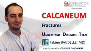 Fracture du calcanéum par le Dr Baudelle [upl. by Wehtta]