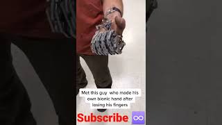 How To Make Bionic Hand  Bionic Finger  Robotic Hand  Iron Man  Iron Hand  The Most Viral Video [upl. by Erasmus212]