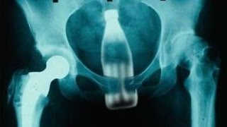 LAS RADIOGRAFIAS MAS RARAS DEL MUNDO [upl. by Hong]