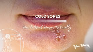 Cold Sores  How to Heal Herpes Naturally [upl. by Neff751]