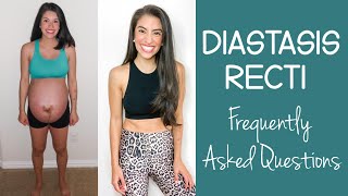 Diastasis Recti FAQS [upl. by Eelytsirk]