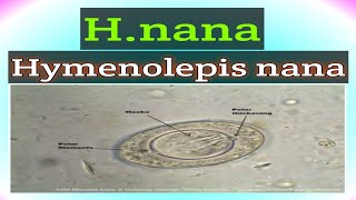 Hymenolepiasis nana  Hnana under Microscope  Shorts Elearn with Technologist [upl. by Gundry]