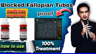 Blocked Fallopian Tubes ka ilaaj by Dr Mustafa blockedfallopiantubes treatment homeopathy facts [upl. by Ida705]