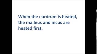 Caloric test Mechanism of Caloric Nystagmus [upl. by Poulter704]