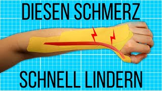 Soforthilfe mit TAPE bei Unterarmschmerzen DeQuervain Tendinitis  Test [upl. by Herv]