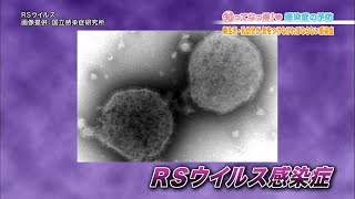 【赤ちゃん要注意！】RSウイルス感染症「知ってなっ得！感染症の予防＃４その４」 [upl. by Burnsed]