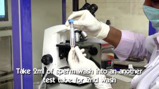 Sperm preparation by Density Gradient Method [upl. by Yonah]