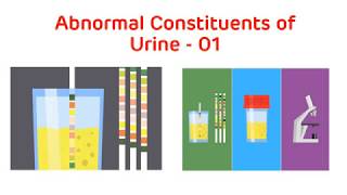 Analysis of Abnormal Urine  Abnormal Urine Constituents Practical Part I  Biochemistry Practical [upl. by Nev]