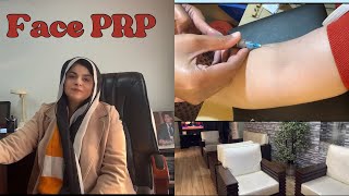 Face PRP and Mesotherapy By DrZartash🥰Best treatment for Acne Marks Fine Lines🥰viral youtube [upl. by Llerrod]