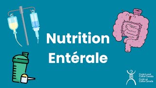 Nutrition Entérale Pour Les MII [upl. by Suhsoj775]