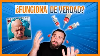 ¿QUÉ le PASA a tu PELO cuando haces PRP  Plasma rico en plaquetas [upl. by Owades]