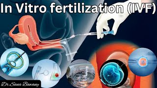 IVF Complete Process Step By Step  In Vitro Fertilization Procedure [upl. by Namlak]