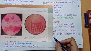 Streptococcus Pyogenes  Morphology  Virulence factors  culture amp lab diagnosis  MICROBIOLOGY [upl. by Damicke]