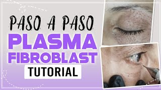 PLASMA PEN FIBROBLAST paso a paso  párpado caído  ojos  PLASMA PEN  plasmapen CarolinaTV [upl. by Stephenson147]